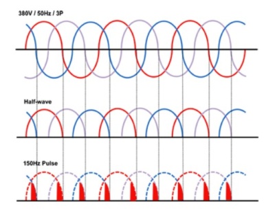 pulzni_system